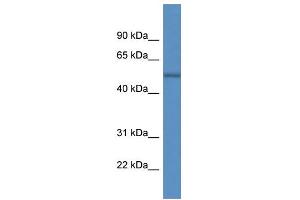 WB Suggested Anti-ARHGAP19 AntibodyTitration: 1.