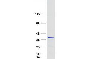 Validation with Western Blot
