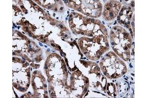 Immunohistochemical staining of paraffin-embedded Kidney tissue using anti-SATB1mouse monoclonal antibody. (SATB1 anticorps)