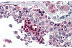 Immunohistochemistry with Human Testis lysate tissue at an antibody concentration of 5.