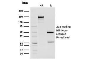 SDS-PAGE Analysis Purified STAT2 Mouse Monoclonal Antibody (STAT2/2650). (STAT2 anticorps)