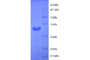 SDS-PAGE (SDS) image for Metallothionein 1G (MT1G) (AA 1-59), (partial) protein (GST tag) (ABIN5713088) (MT1G Protein (AA 1-59, partial) (GST tag))