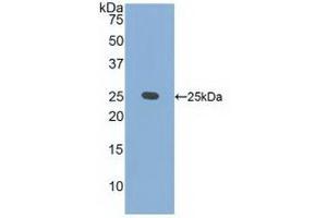 Western blot analysis of recombinant Human CRADD. (CRADD anticorps  (AA 1-199))