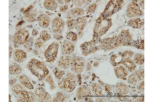 Immunoperoxidase of monoclonal antibody to TPP1 on formalin-fixed paraffin-embedded human salivary gland.