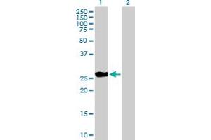 Western Blot analysis of BNIP1 expression in transfected 293T cell line by BNIP1 MaxPab polyclonal antibody.