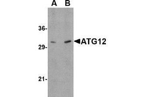 Western blot: ATG12 antibody staining of Human brain tissue lysate at (A) 0. (ATG12 anticorps  (N-Term))