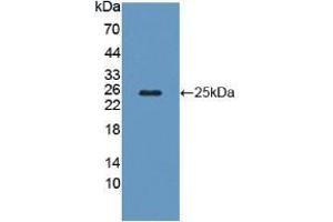 Figure. (Calcyphosine anticorps  (AA 1-189))