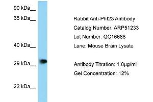 WB Suggested Anti-Phf23 Antibody   Titration: 1. (PHF23 anticorps  (N-Term))