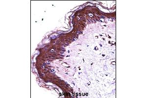 S100A7 Antibody (N-term) ((ABIN657716 and ABIN2846704))immunohistochemistry analysis in formalin fixed and paraffin embedded human skin tissue followed by peroxidase conjugation of the secondary antibody and DAB staining.
