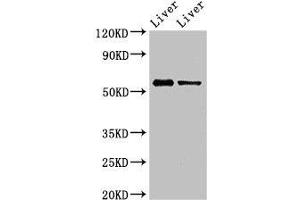 Western Blot Positive WB detected in: Mouse liver tissue, Rat liver tissue All lanes: ETV1 antibody at 3 μg/mL Secondary Goat polyclonal to rabbit IgG at 1/50000 dilution Predicted band size: 56, 54, 53, 44, 49, 51 kDa Observed band size: 56 kDa (ETV1 anticorps  (AA 61-332))