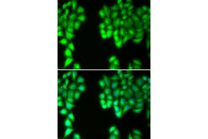 Immunofluorescence analysis of U20S cell using MALT1 antibody. (MALT1 anticorps  (AA 125-450))
