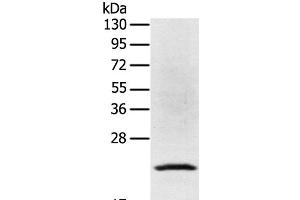 Western Blot analysis of Jurkat cell using TP53I11 Polyclonal Antibody at dilution of 1:400 (TP53I11 anticorps)