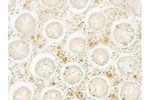 ABIN6260943 and ABIN6266830 at 1/100 staining human normal colon tissue by IHC-P. (Collagen IV anticorps)