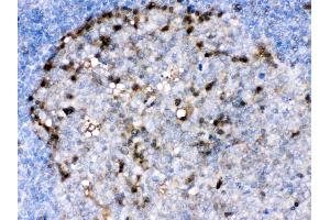 IHC analysis of ADA/Adenosine Deaminase using anti- ADA/Adenosine Deaminase antibody . (ADA anticorps  (AA 135-363))