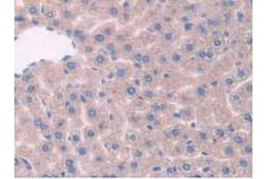 IHC-P analysis of Mouse Liver Tissue, with DAB staining. (TPP1 anticorps  (AA 198-562))