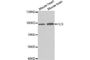 Western blot analysis of extracts of various cell lines, using FES antibody. (FES anticorps  (AA 120-420))