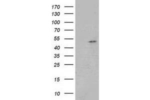 Western Blotting (WB) image for anti-Glutathione Synthetase (GSS) antibody (ABIN1498539) (Glutathione Synthetase anticorps)
