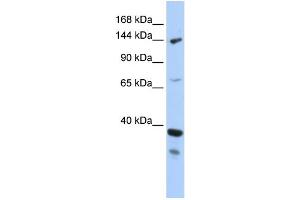 WB Suggested Anti-DHX37 Antibody Titration:  0. (DHX37 anticorps  (N-Term))