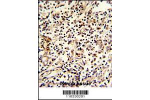 Formalin-fixed and paraffin-embedded human lymph reacted with PCM-1 Antibody , which was peroxidase-conjugated to the secondary antibody, followed by DAB staining. (PCM1 anticorps  (C-Term))