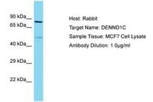 Image no. 1 for anti-DENN/MADD Domain Containing 1C (DENND1C) (C-Term) antibody (ABIN6750558) (DENND1C anticorps  (C-Term))