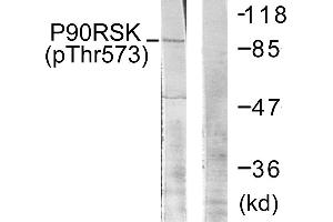 Western blot analysis of extracts from 293 cells, treated with UV (30 mins), using p90 RSK (Phospho-Thr573) antibody. (RPS6KA3 anticorps  (pThr573))