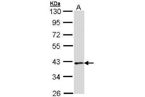 WB Image Sample (30 ug of whole cell lysate) A: Raji 10% SDS PAGE antibody diluted at 1:1000 (DMC1 anticorps  (Center))
