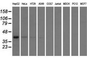 Western blot analysis of extracts (35 µg) from 9 different cell lines by using anti-HIBCH monoclonal antibody. (HIBCH anticorps)