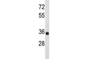 ISL1 antibody western blot analysis in mouse bladder tissue lysate.