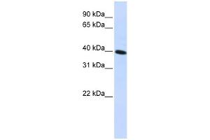 WB Suggested Anti-CARKD Antibody Titration:  0. (Carkd anticorps  (Middle Region))