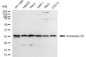 Western blotting analysis using Homeobox C6 antibody (ABIN7798994).