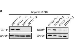A hPSC-based population study discovers that GSTT1-null pancreatic β-like cells are hypersensitive to propargite-induced cell death.
