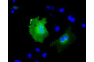 Anti-KBTBD7 mouse monoclonal antibody (ABIN2453189) immunofluorescent staining of COS7 cells transiently transfected by pCMV6-ENTRY KBTBD7 (RC205559). (KBTBD7 anticorps)
