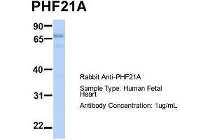 Host:  Rabbit  Target Name:  PHF21A  Sample Type:  Human Fetal Heart  Antibody Dilution:  1. (PHF21A anticorps  (N-Term))