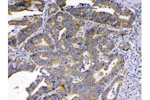 IHC analysis of SCF using anti-SCF antibody .