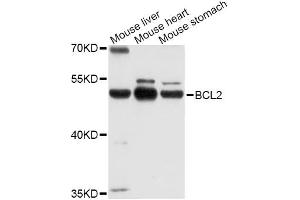 Western blot analysis of extracts of various cell lines, using POU2F3 Antibody (ABIN4904821) at 1:1000 dilution.