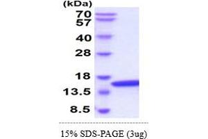 SDS-PAGE (SDS) image for Ubiquitin-Conjugating Enzyme E2D 2 (UBE2D2) (AA 1-147) protein (ABIN5855026) (UBE2D2 Protein (AA 1-147))