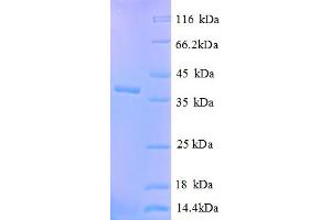 SDS-PAGE (SDS) image for Calcium Activated Nucleotidase 1 (CANT1) (AA 80-397), (partial) protein (His tag) (ABIN4976340) (CANT1 Protein (AA 80-397, partial) (His tag))