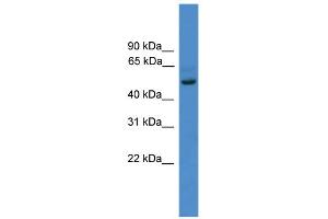 WB Suggested Anti-ZNF277 Antibody Titration:  0. (ZNF277 anticorps  (N-Term))
