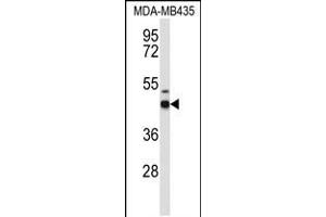 Western blot analysis of GABRD Antibody in MDA-MB435 cell line lysates (35ug/lane)