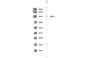 Western blot analysis of lysates from COLO205 cells(UV,30 min treatment), using N Antibody at 1/1000 dilution.