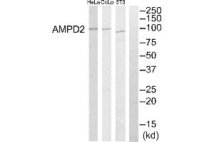 Western blot analysis of extracts from HeLa cells, NIH-3T3 cells and COLO205 cells, using AMPD2 antibody. (AMPD2 anticorps)