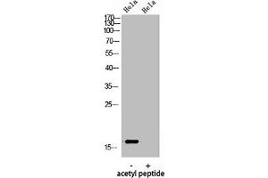 Western Blot analysis of hela using Acetyl-Histone H3 (K9) Polyclonal Antibody.