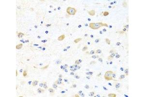 Immunohistochemistry of paraffin-embedded Mouse brain using INPP5K Polyclonal Antibody at dilution of 1:100 (40x lens).
