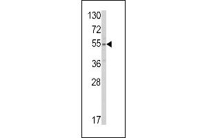SLC38A3 anticorps  (AA 442-468)