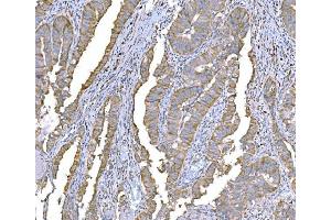 IHC analysis of SND1 using anti-SND1 antibody (ABIN7600526). (SND1 anticorps  (AA 20-204))