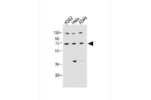 All lanes : Anti-SLC22A4 Antibody (C-term) at 1:1000 dilution Lane 1: K562 whole cell lysate Lane 2: Hela whole cell lysate Lane 3: A549 whole cell lysate Lysates/proteins at 20 μg per lane. (SLC22A4 anticorps  (C-Term))