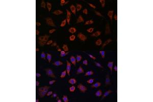 Immunofluorescence analysis of L929 cells using CYTH1 antibody (ABIN7266661) at dilution of 1:100.