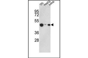 Image no. 1 for anti-Histone Acetyltransferase 1 (HAT1) (AA 390-419), (C-Term) antibody (ABIN356621) (HAT1 anticorps  (C-Term))
