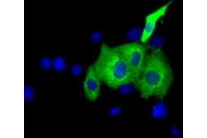 Image no. 1 for anti-Insulin-Like Growth Factor 2 mRNA Binding Protein 2 (IGF2BP2) antibody (ABIN1498822) (IGF2BP2 anticorps)