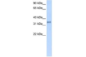 WB Suggested Anti-CA4 Antibody Titration:  0. (CA4 anticorps  (C-Term))